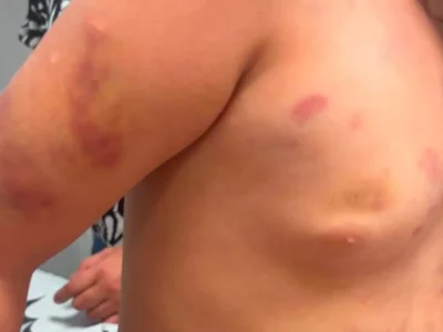 Padrasto preso após agredir menina autista de 6 anos